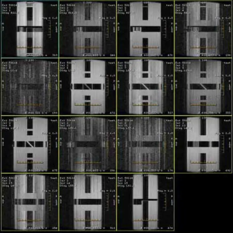 FSE ir GRE artefaktas